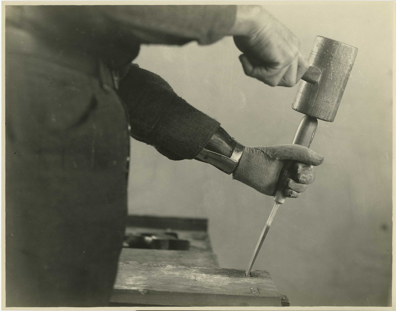 Illustration for article titled Horrifying Vintage Army Medical Photos Make Me Appreciate Modern Medicine Even More